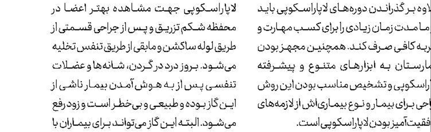 امکان درمان 80 درصد تومورهای سرطانی استخوان 