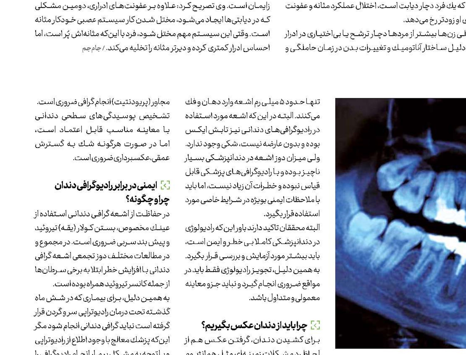 رادیوگرافی دندان؛ خطرناك یا بی‌خطر؟