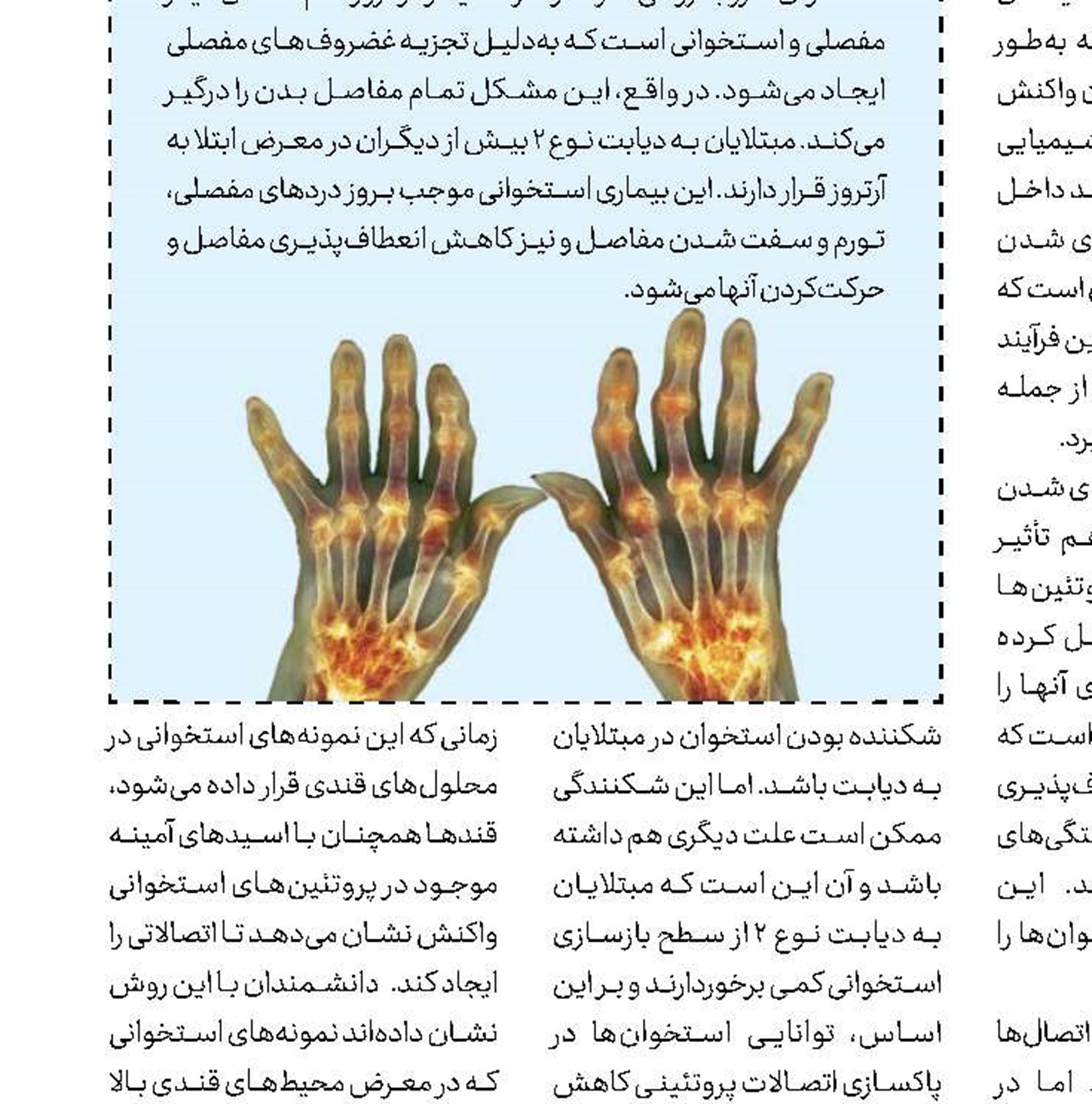 سخت‌تر شدن لاغری با استرس كرونا 