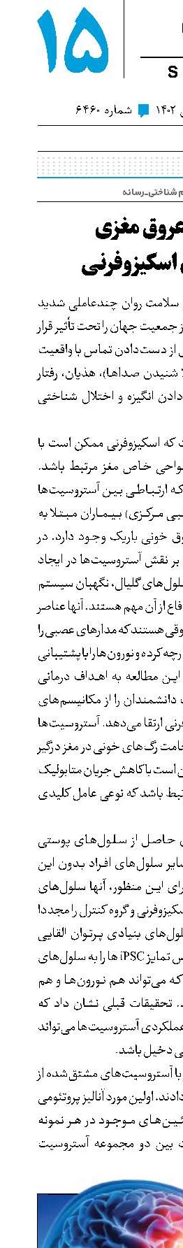 اختلال عروق مغزی در بیماری اسکیزوفرنی