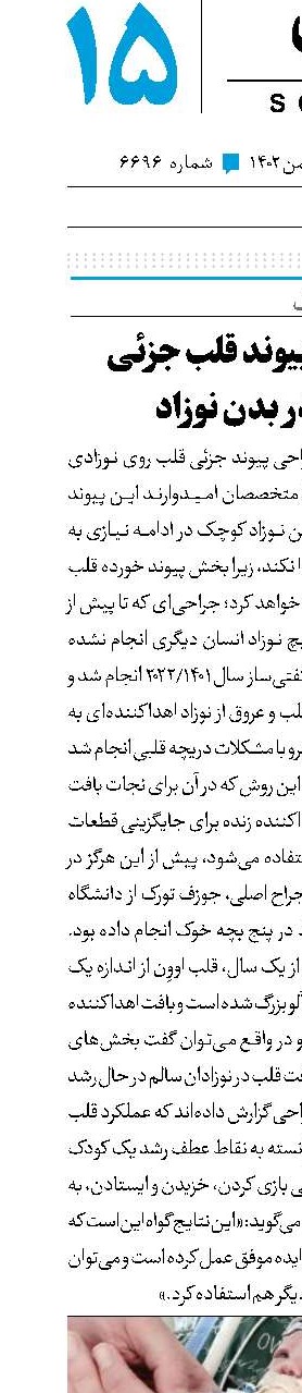 رشد اولین پیوند قلب جزئی جهان در بدن نوزاد