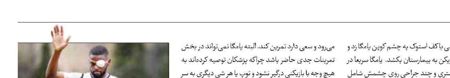 آخرین وضعیت چشم کوین یامگا