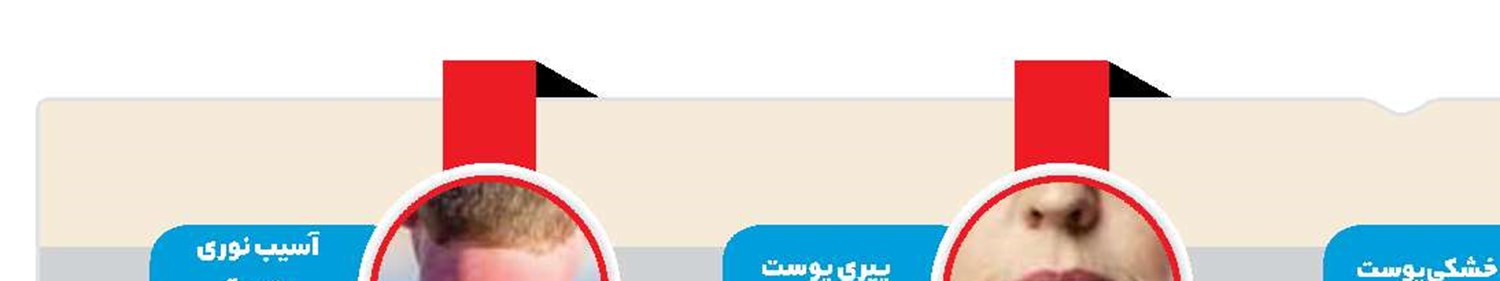 چهار مورد از شایع‌ترین بیماری‌های پوستی