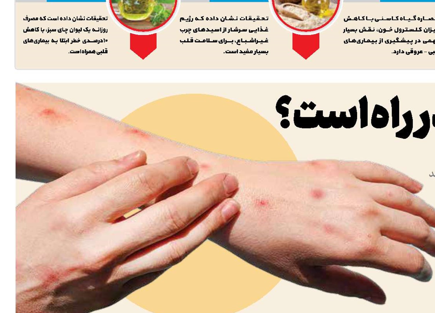 پاندمی آبله میمون در راه است؟