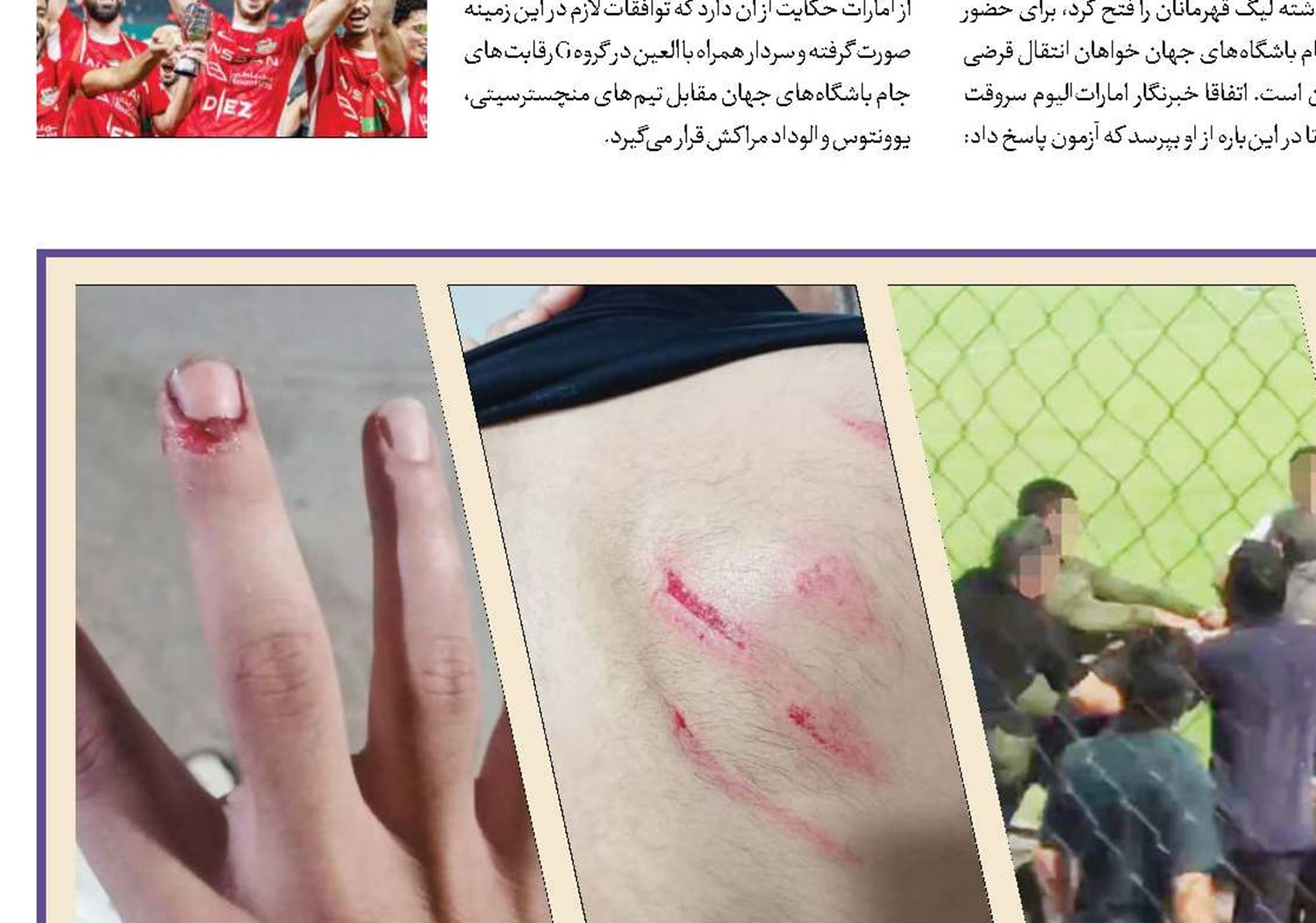 تیغ تبر بر سر فوتبال!