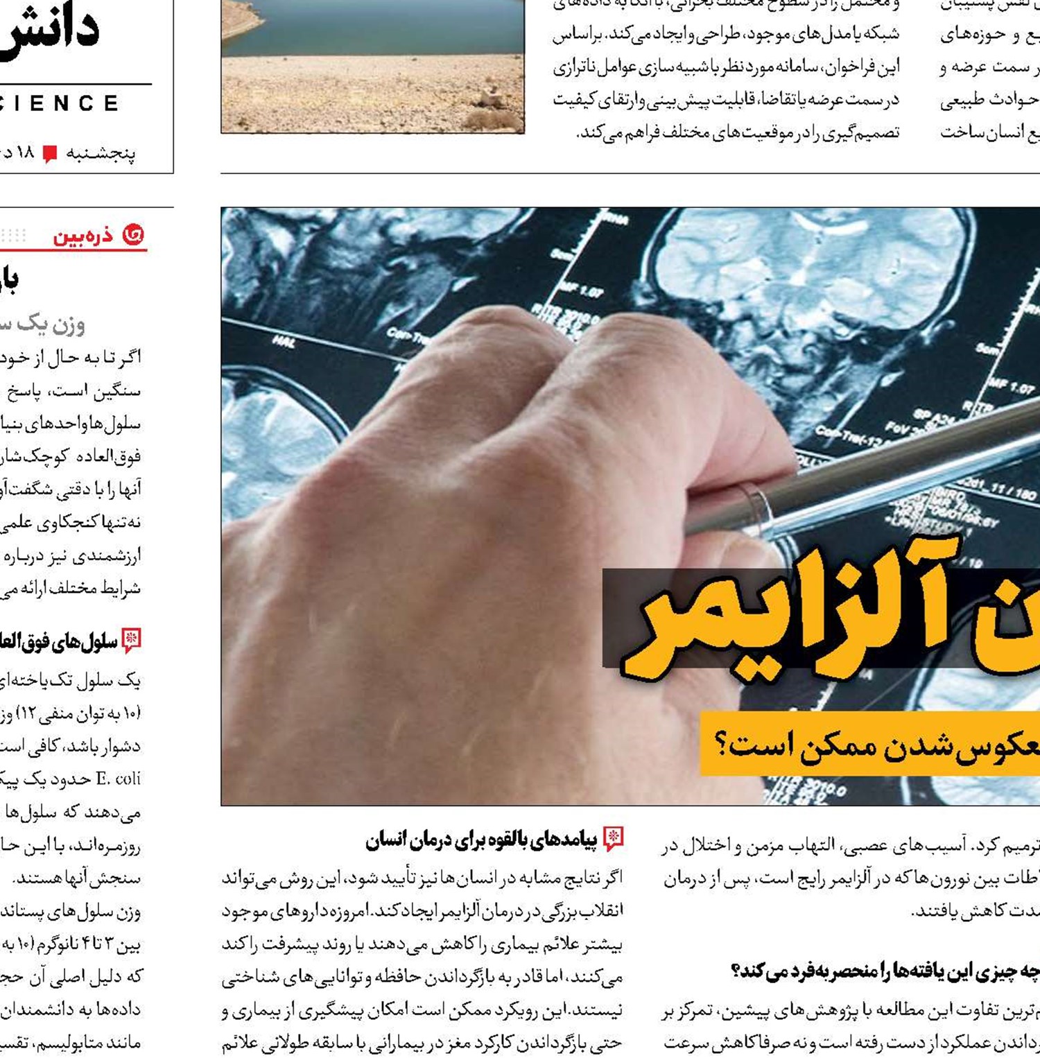 دوربرگردان آلزایمر