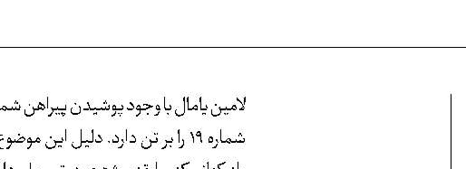 نیمار به بازی دوم برزیل هم نمی‌رسد